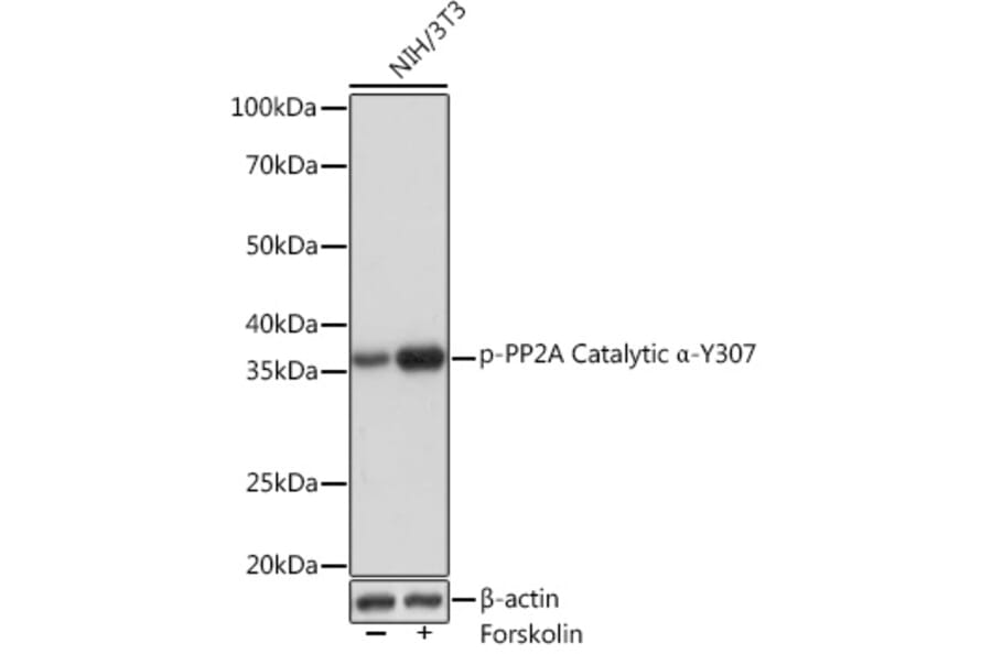 Western Blot - Anti-PP2A-alpha (phospho Tyr307) Antibody [ARC1589] (A308126) - Antibodies.com