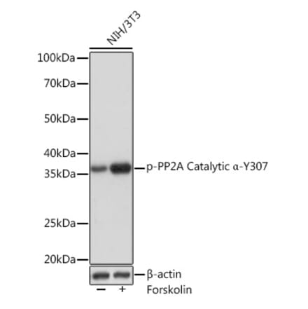 Western Blot - Anti-PP2A-alpha (phospho Tyr307) Antibody [ARC1589] (A308126) - Antibodies.com