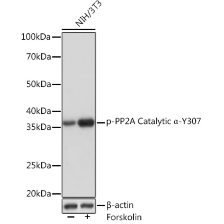 Western Blot - Anti-PP2A-alpha (phospho Tyr307) Antibody [ARC1589] (A308126) - Antibodies.com