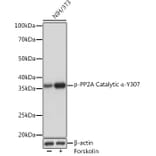 Western Blot - Anti-PP2A-alpha (phospho Tyr307) Antibody [ARC1589] (A308126) - Antibodies.com