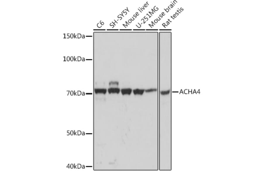 Western Blot - Anti-Nicotinic Acetylcholine Receptor alpha 4/CHRNA4 Antibody [ARC1822] (A308128) - Antibodies.com