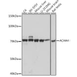 Western Blot - Anti-Nicotinic Acetylcholine Receptor alpha 4/CHRNA4 Antibody [ARC1822] (A308128) - Antibodies.com