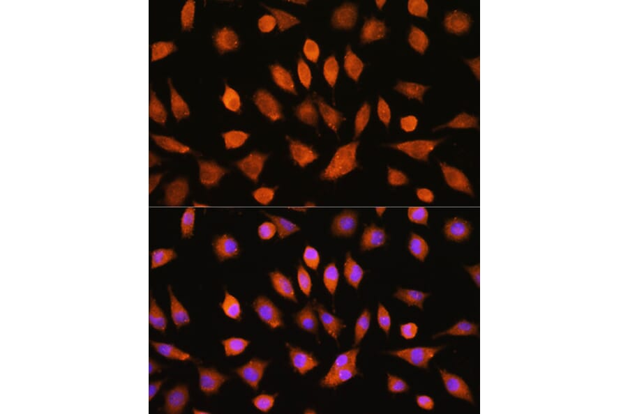 Immunofluorescence - Anti-PI4KA Antibody (A308129) - Antibodies.com