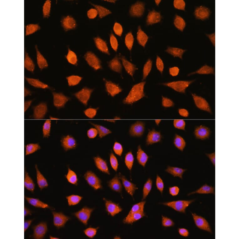 Immunofluorescence - Anti-PI4KA Antibody (A308129) - Antibodies.com
