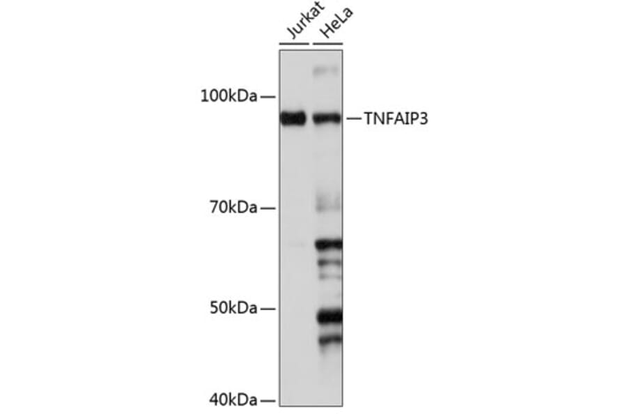 Western Blot - Anti-TNFAIP3 Antibody [ARC0355] (A308131) - Antibodies.com
