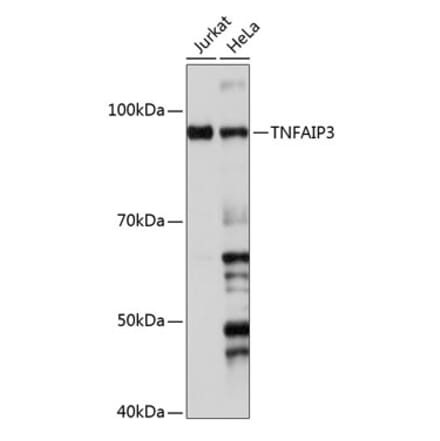 Western Blot - Anti-TNFAIP3 Antibody [ARC0355] (A308131) - Antibodies.com