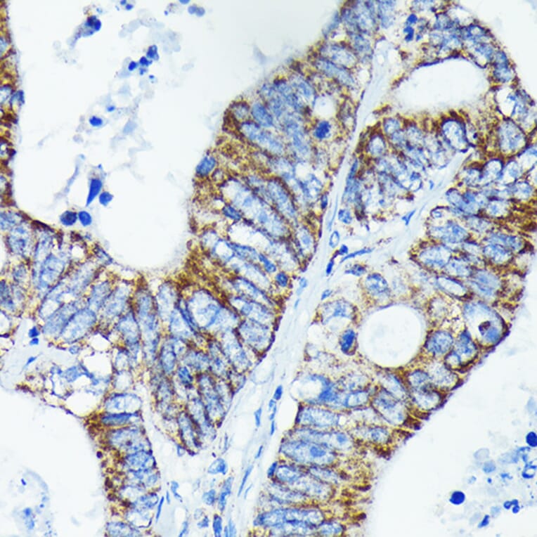 Immunohistochemistry - Anti-TNFAIP3 Antibody [ARC0355] (A308131) - Antibodies.com