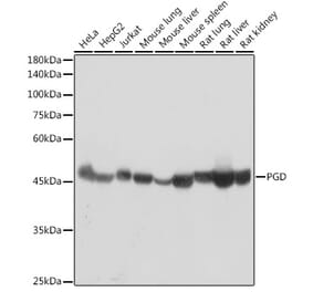 Western Blot - Anti-PGD Antibody [ARC2516] (A308132) - Antibodies.com