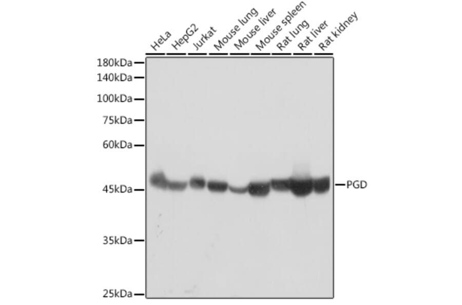 Western Blot - Anti-PGD Antibody [ARC2516] (A308132) - Antibodies.com