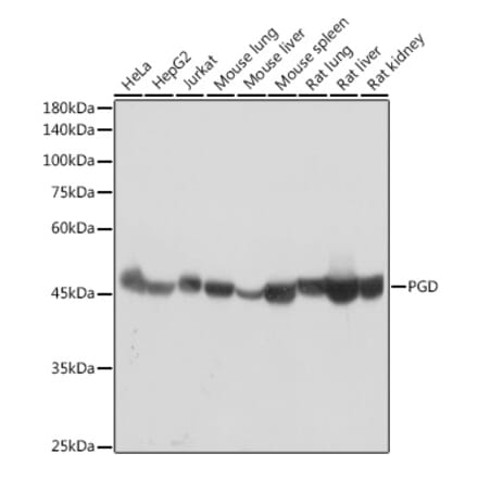 Western Blot - Anti-PGD Antibody [ARC2516] (A308132) - Antibodies.com