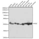 Western Blot - Anti-PGD Antibody [ARC2516] (A308132) - Antibodies.com