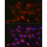 Immunofluorescence - Anti-PGD Antibody [ARC2516] (A308132) - Antibodies.com