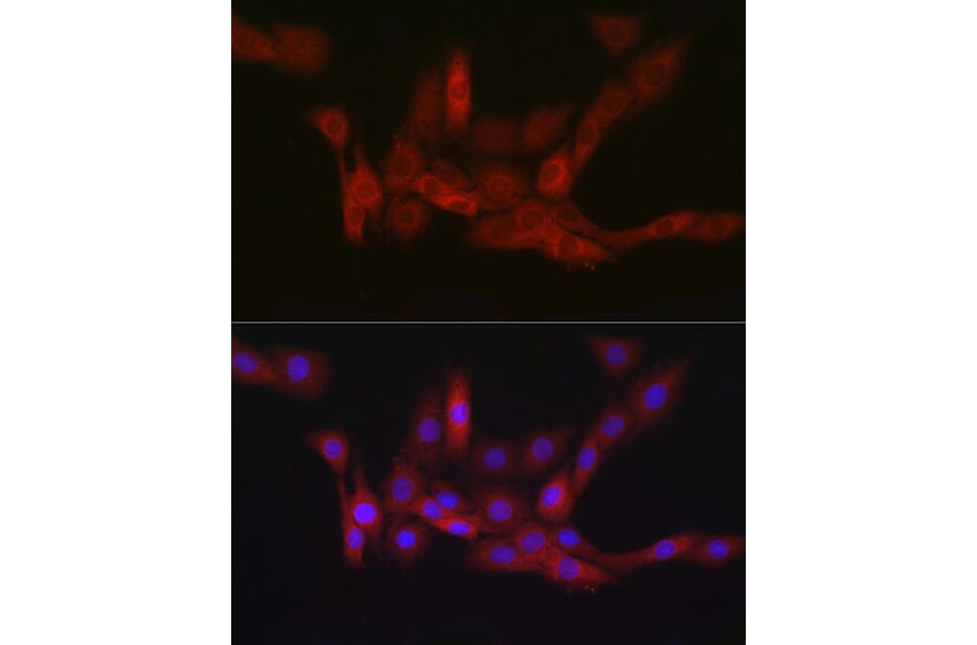 Immunofluorescence - Anti-PGD Antibody [ARC2516] (A308132) - Antibodies.com