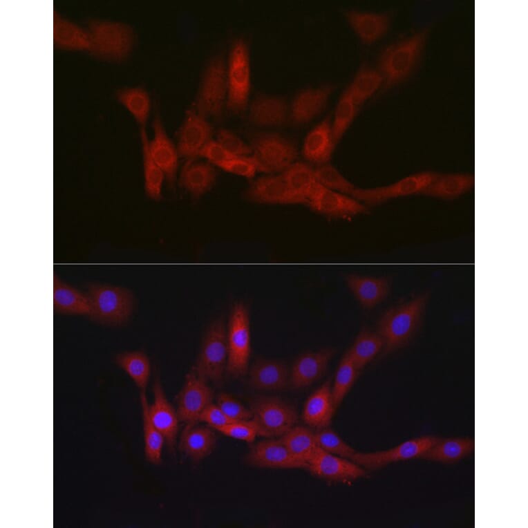 Immunofluorescence - Anti-PGD Antibody [ARC2516] (A308132) - Antibodies.com