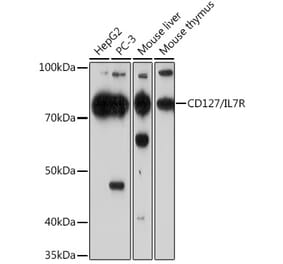 Western Blot - Anti-CD127 Antibody [ARC0672] (A308134) - Antibodies.com