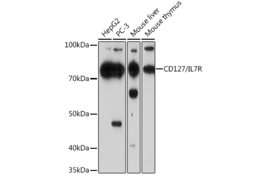 Western Blot - Anti-CD127 Antibody [ARC0672] (A308134) - Antibodies.com