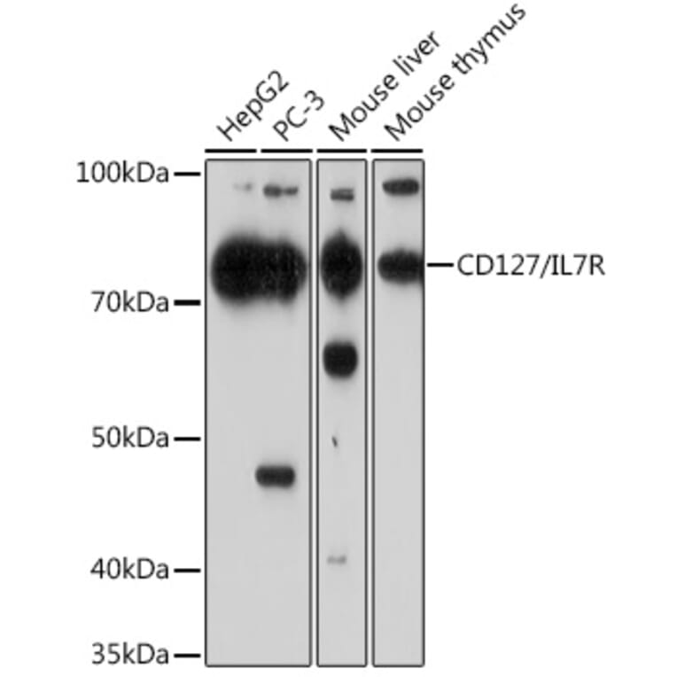 Western Blot - Anti-CD127 Antibody [ARC0672] (A308134) - Antibodies.com