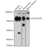Western Blot - Anti-CD127 Antibody [ARC0672] (A308134) - Antibodies.com