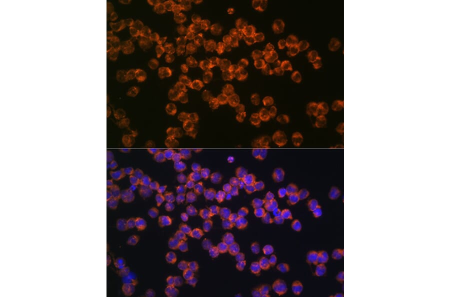 Immunofluorescence - Anti-CD127 Antibody [ARC0672] (A308134) - Antibodies.com