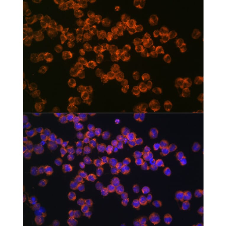 Immunofluorescence - Anti-CD127 Antibody [ARC0672] (A308134) - Antibodies.com