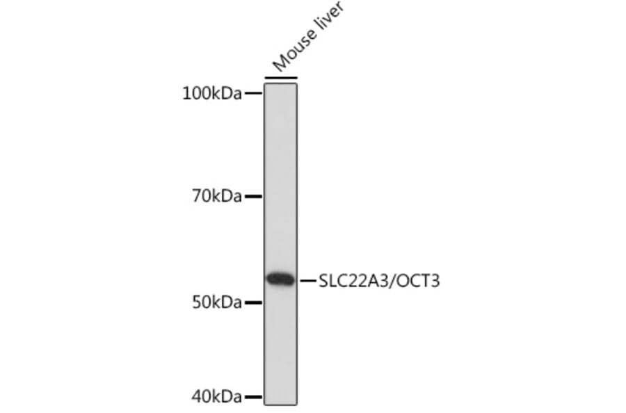 Western Blot - Anti-SLC22A3/OCT3 Antibody (A308135) - Antibodies.com