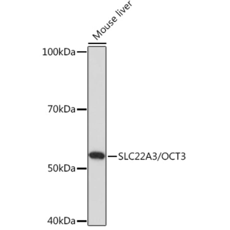 Western Blot - Anti-SLC22A3/OCT3 Antibody (A308135) - Antibodies.com