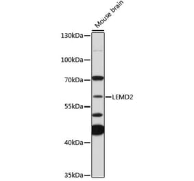 Western Blot - Anti-LEMD2 Antibody (A308136) - Antibodies.com