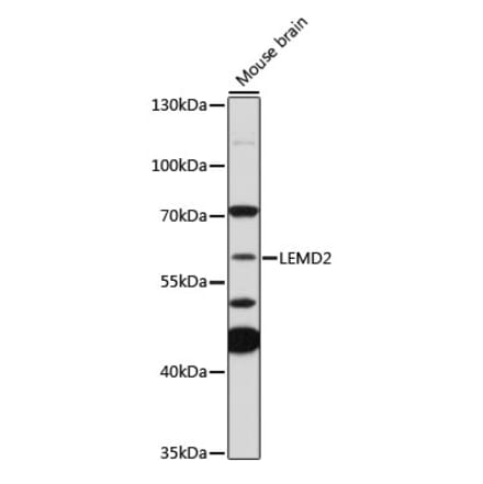 Western Blot - Anti-LEMD2 Antibody (A308136) - Antibodies.com