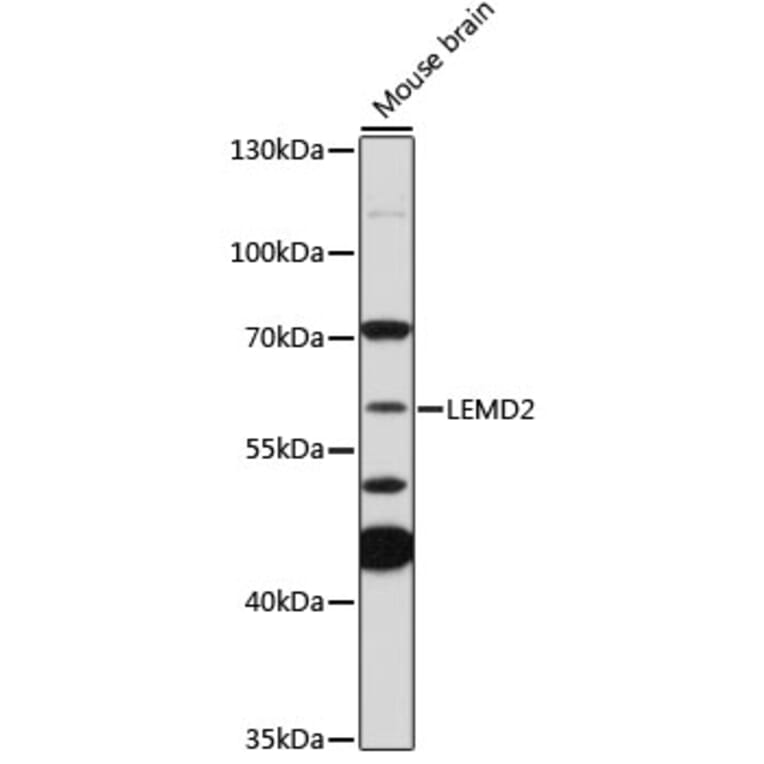 Western Blot - Anti-LEMD2 Antibody (A308136) - Antibodies.com