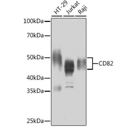 Western Blot - Anti-CD82 Antibody [ARC1501] (A308137) - Antibodies.com