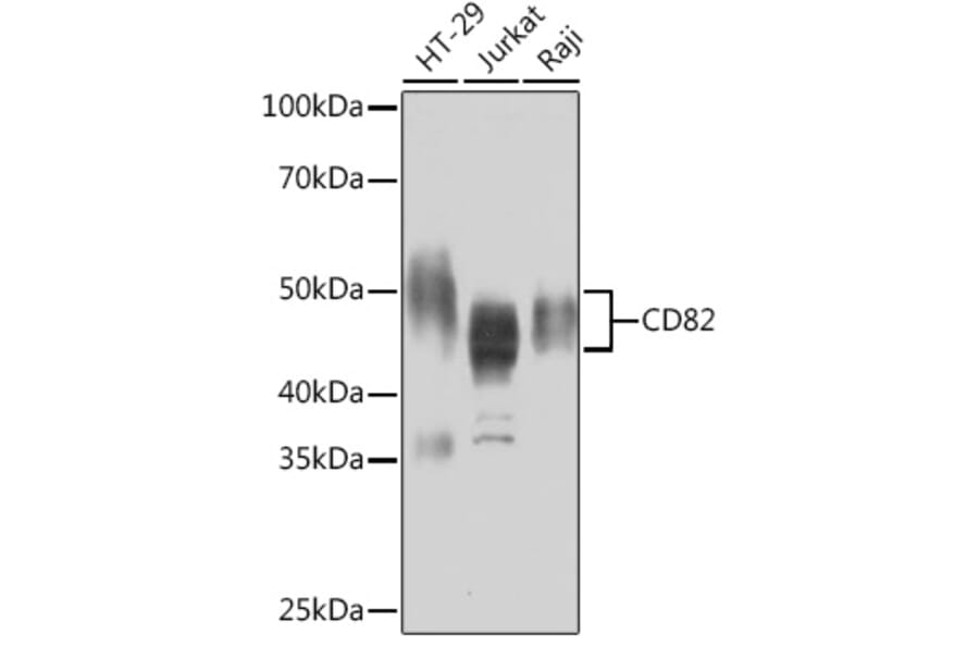 Western Blot - Anti-CD82 Antibody [ARC1501] (A308137) - Antibodies.com