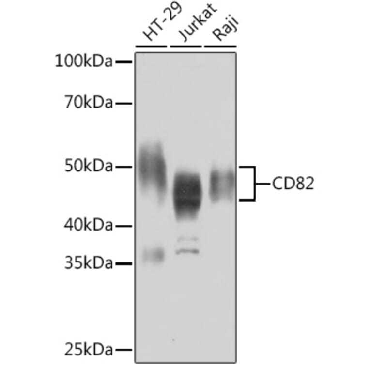 Western Blot - Anti-CD82 Antibody [ARC1501] (A308137) - Antibodies.com