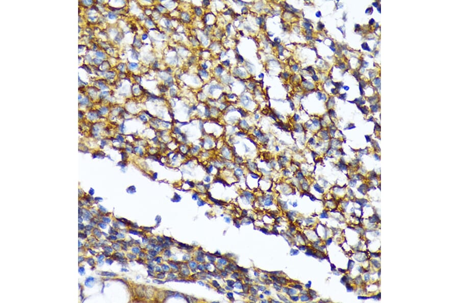 Immunohistochemistry - Anti-CD82 Antibody [ARC1501] (A308137) - Antibodies.com