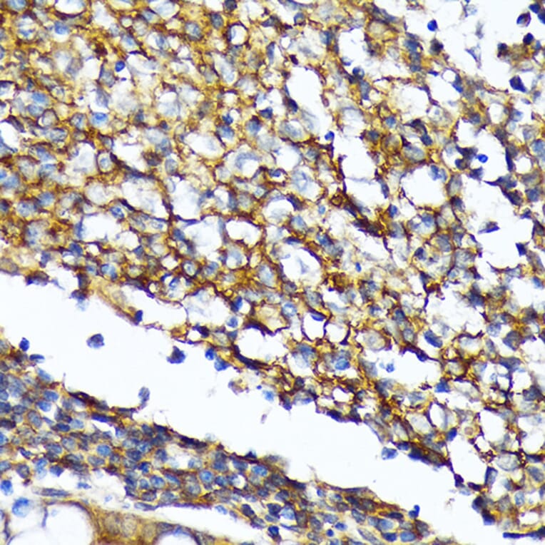 Immunohistochemistry - Anti-CD82 Antibody [ARC1501] (A308137) - Antibodies.com