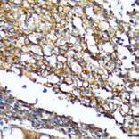 Immunohistochemistry - Anti-CD82 Antibody [ARC1501] (A308137) - Antibodies.com