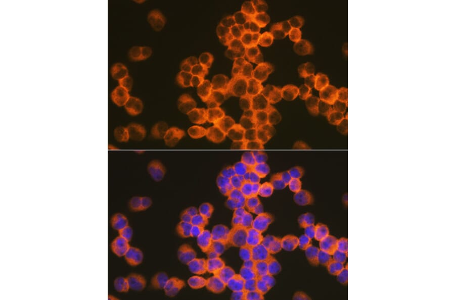 Immunofluorescence - Anti-CD82 Antibody [ARC1501] (A308137) - Antibodies.com