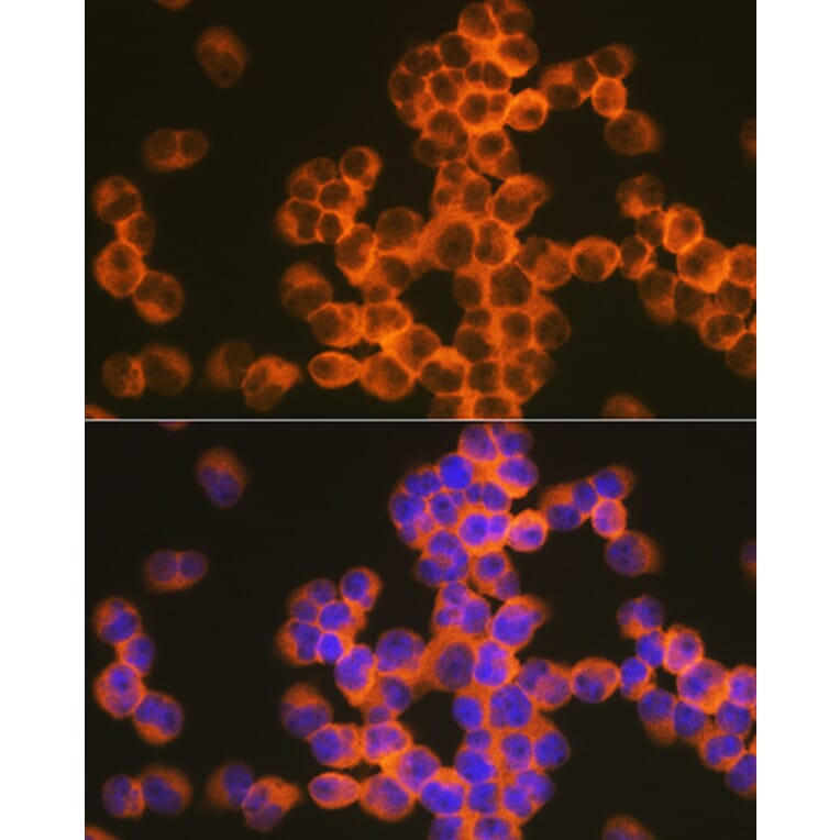 Immunofluorescence - Anti-CD82 Antibody [ARC1501] (A308137) - Antibodies.com