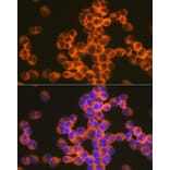 Immunofluorescence - Anti-CD82 Antibody [ARC1501] (A308137) - Antibodies.com
