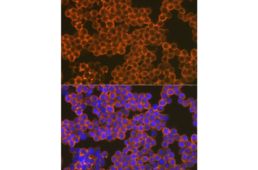 Immunofluorescence - Anti-CD82 Antibody [ARC1501] (A308137) - Antibodies.com
