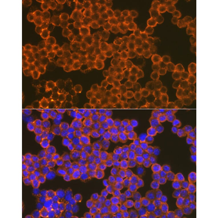 Immunofluorescence - Anti-CD82 Antibody [ARC1501] (A308137) - Antibodies.com