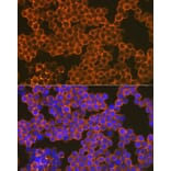 Immunofluorescence - Anti-CD82 Antibody [ARC1501] (A308137) - Antibodies.com