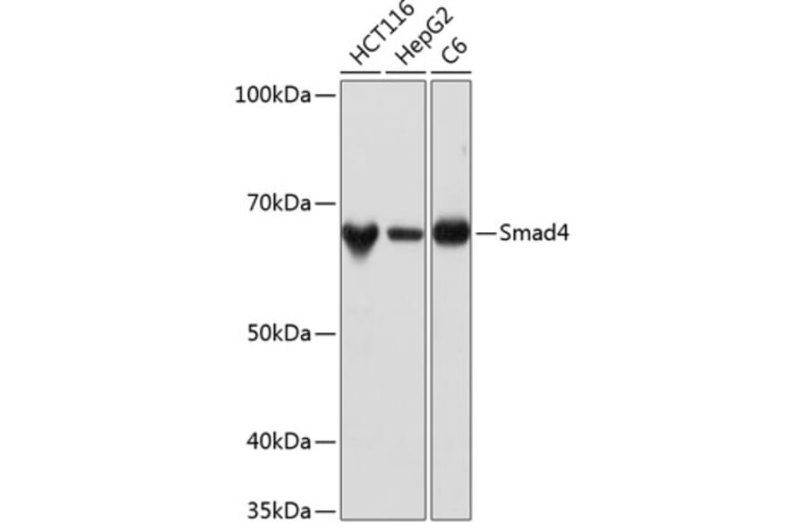Western Blot - Anti-Smad4 Antibody [ARC5009-06] (A308139) - Antibodies.com