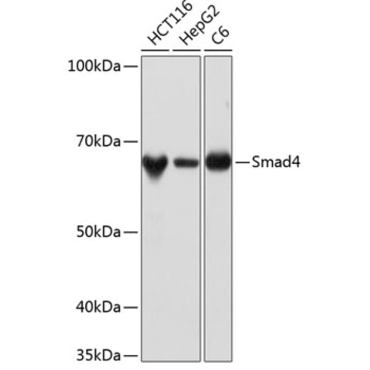 Western Blot - Anti-Smad4 Antibody [ARC5009-06] (A308139) - Antibodies.com