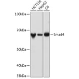 Western Blot - Anti-Smad4 Antibody [ARC5009-06] (A308139) - Antibodies.com