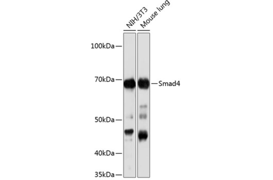 Western Blot - Anti-Smad4 Antibody [ARC5009-06] (A308139) - Antibodies.com