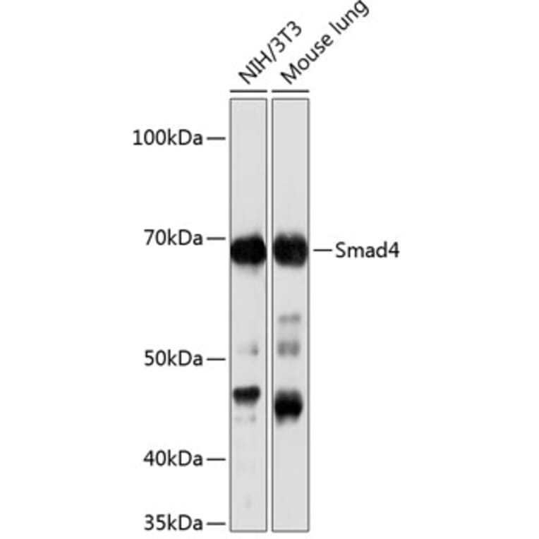 Western Blot - Anti-Smad4 Antibody [ARC5009-06] (A308139) - Antibodies.com