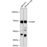 Western Blot - Anti-Smad4 Antibody [ARC5009-06] (A308139) - Antibodies.com