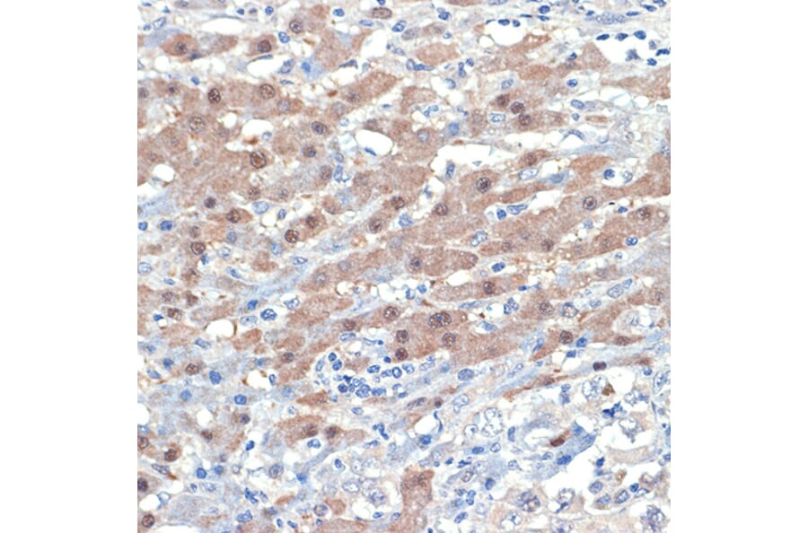 Immunohistochemistry - Anti-Smad4 Antibody [ARC5009-06] (A308139) - Antibodies.com