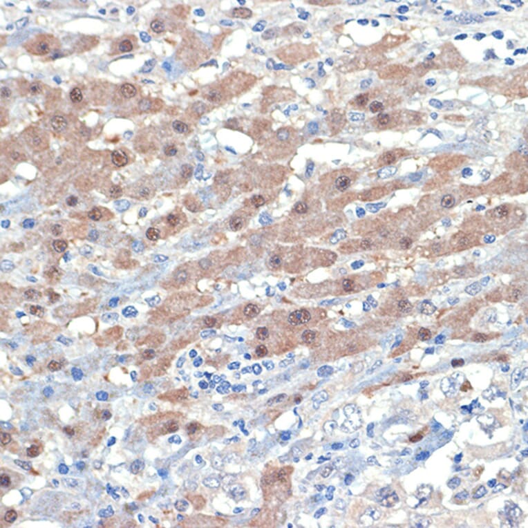 Immunohistochemistry - Anti-Smad4 Antibody [ARC5009-06] (A308139) - Antibodies.com