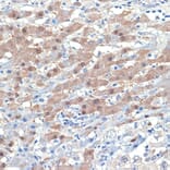 Immunohistochemistry - Anti-Smad4 Antibody [ARC5009-06] (A308139) - Antibodies.com